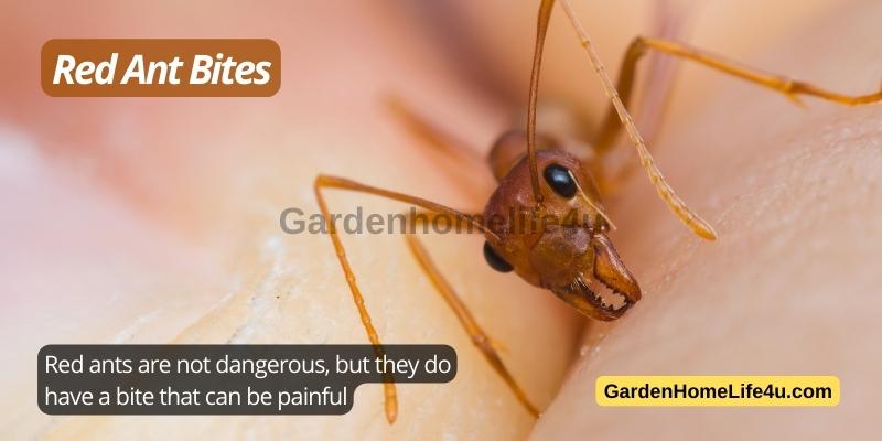 Common Bug Stings in the UK 4