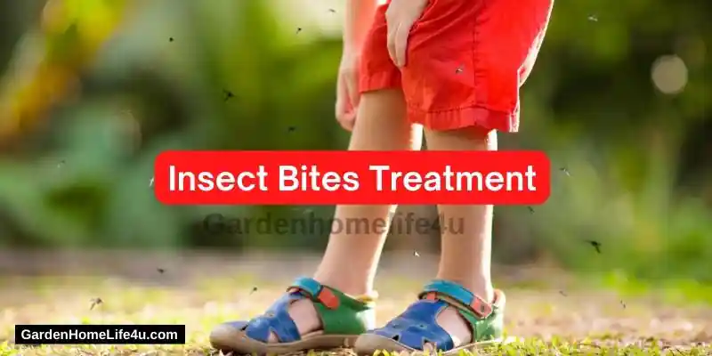 How To Treat Insect Bites Naturally