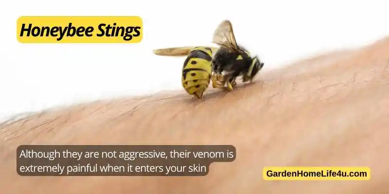 Common Bug Stings in the UK 7